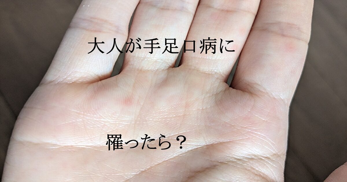 大人 手足口病